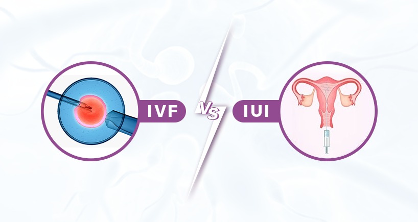 IVF or IUI: Which Fertility Treatment is Right for You?